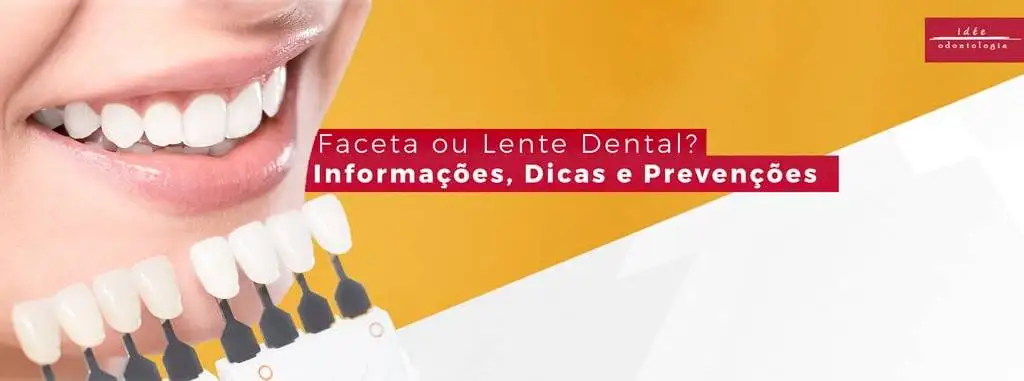 Faceta Dental ou Lente Dental?| Informações, Dicas e Prevenções
